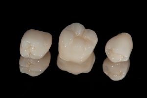 Zirconia Crowns: The Modern Solution for Strong, Natural-Looking Teeth