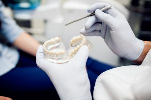 Dental Implants vs. Bridges – Which Is Better for You?