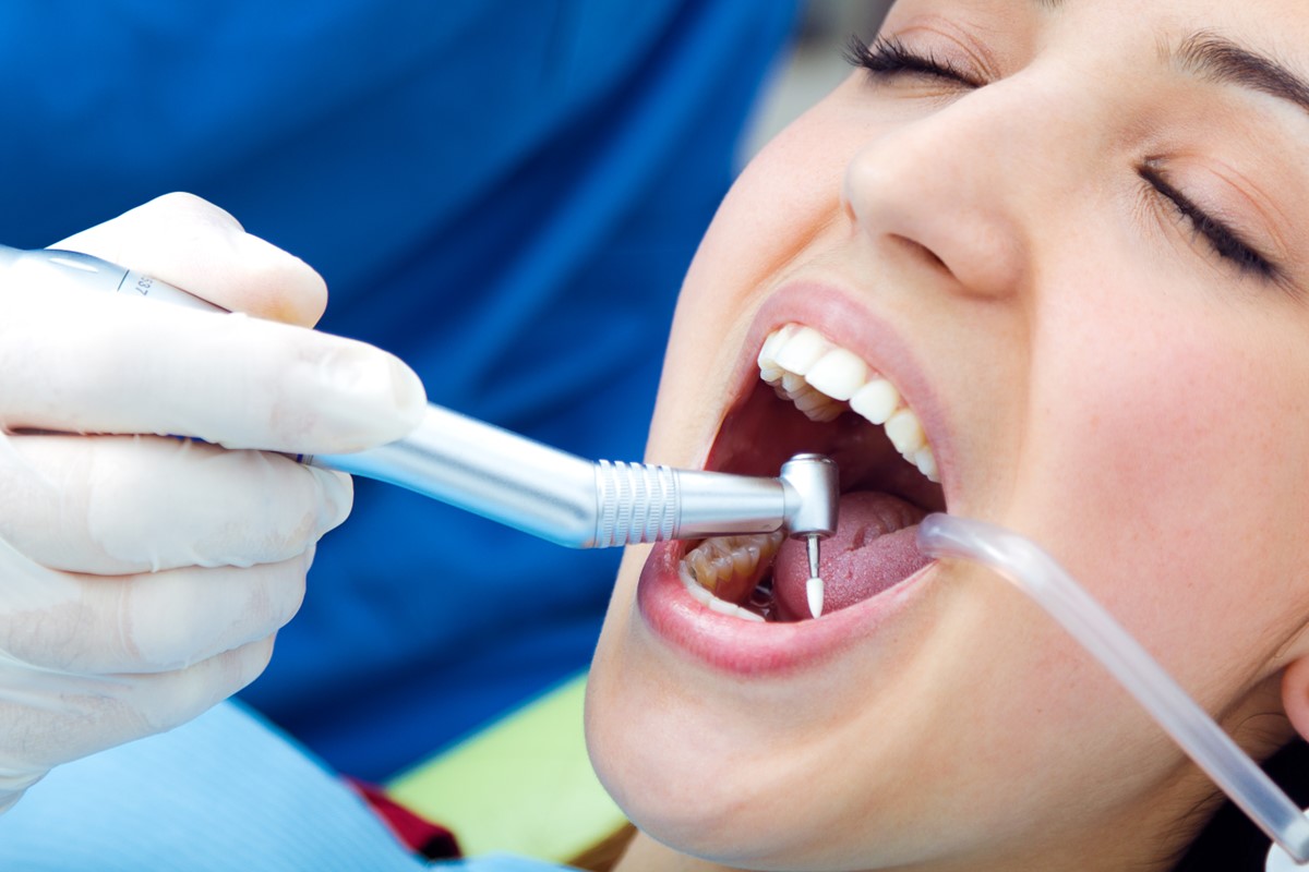 Best No 1 Dental Implants in Nagpur