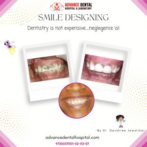 top 3 dentist in nagpur