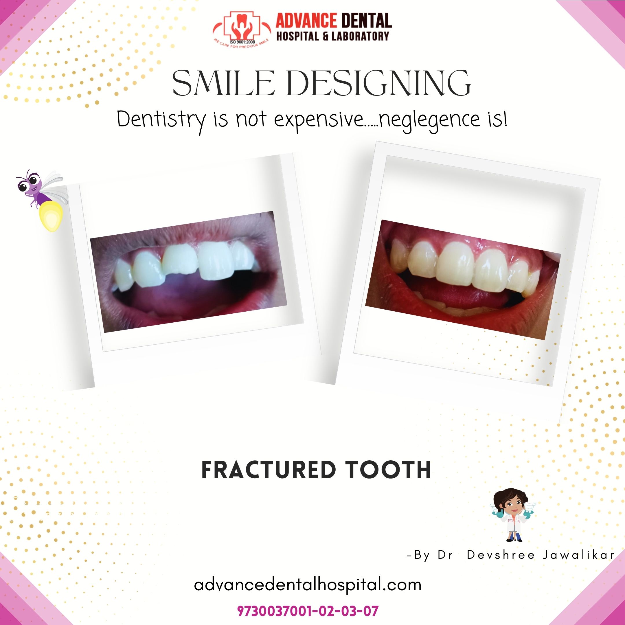 Teeth Whitening Treatments in Nagpur: Brighten Your Smile Safely