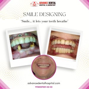 dental professionals in nagpur
