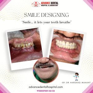 dental surgeon in nagpur