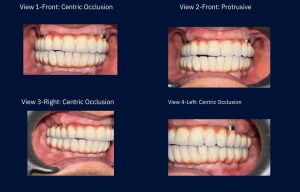 Advance Dental Hospital