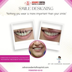 best dental implant clinic in nagpur