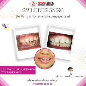 dental clinic in ramdaspeth nagpur
