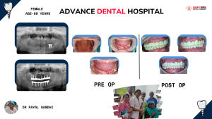 Find the Best Dental Care in Nagpur at Advance Dental Hospital