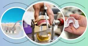 Understanding Crown Teeth: A Complete Guide to Dental Crowns in Dentistry